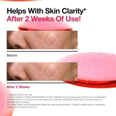 1754922885_717QhPG3fYL._SL1500_.jpg ANUA Niacinamide 10 + TXA 4 Serum, Hyaluronic Acid, Tranexamic acid, Vitamin B12, Facial Serum for Glass Skin, Clarifying, Radiant Complexion with Natural Color, Korean Skin Care (30ml /1.01 fl.oz)