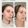 Topicals Faded Brightening and Clearing Serum | Reduces Discoloration Post-Blemish Marks Scars Spots Contains Kojic Acid Niacinamide Dermatologist-tested Vegan Cruelty-Free Fl Oz